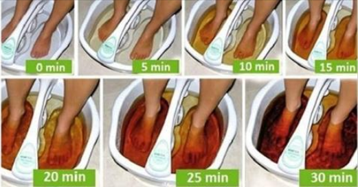 did you know that you can detox your body through your feet hangover cure - Did You Know That You Can Detox Your Body Through Your Feet? – Hangover Cure