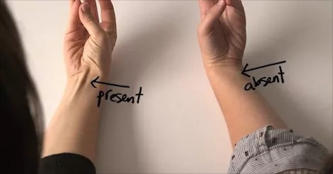 does your tendon pop out of your your wrist like this if so heres what it means - Does Your Tendon Pop Out Of Your Your Wrist Like This? If So, Here’s What It Means