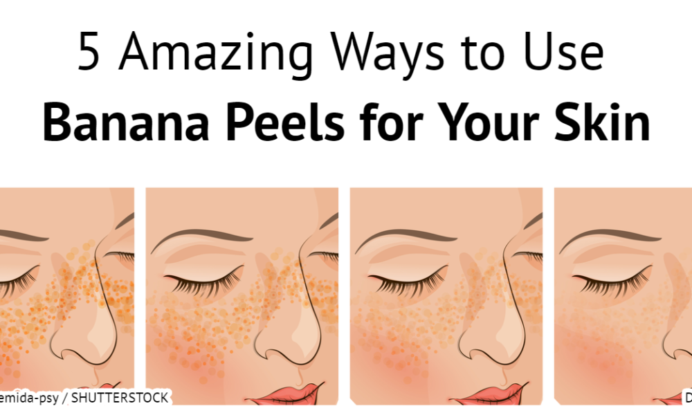 5 amazing ways to use banana peels for your skin hangover cure 1000x600 - 5 Amazing Ways to Use Banana Peels for Your Skin – Hangover Cure