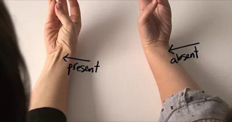 1533856894 does your tendon pop out of your your wrist like this if so heres what it means - Does Your Tendon Pop Out Of Your Your Wrist Like This? If So, Here’s What It Means
